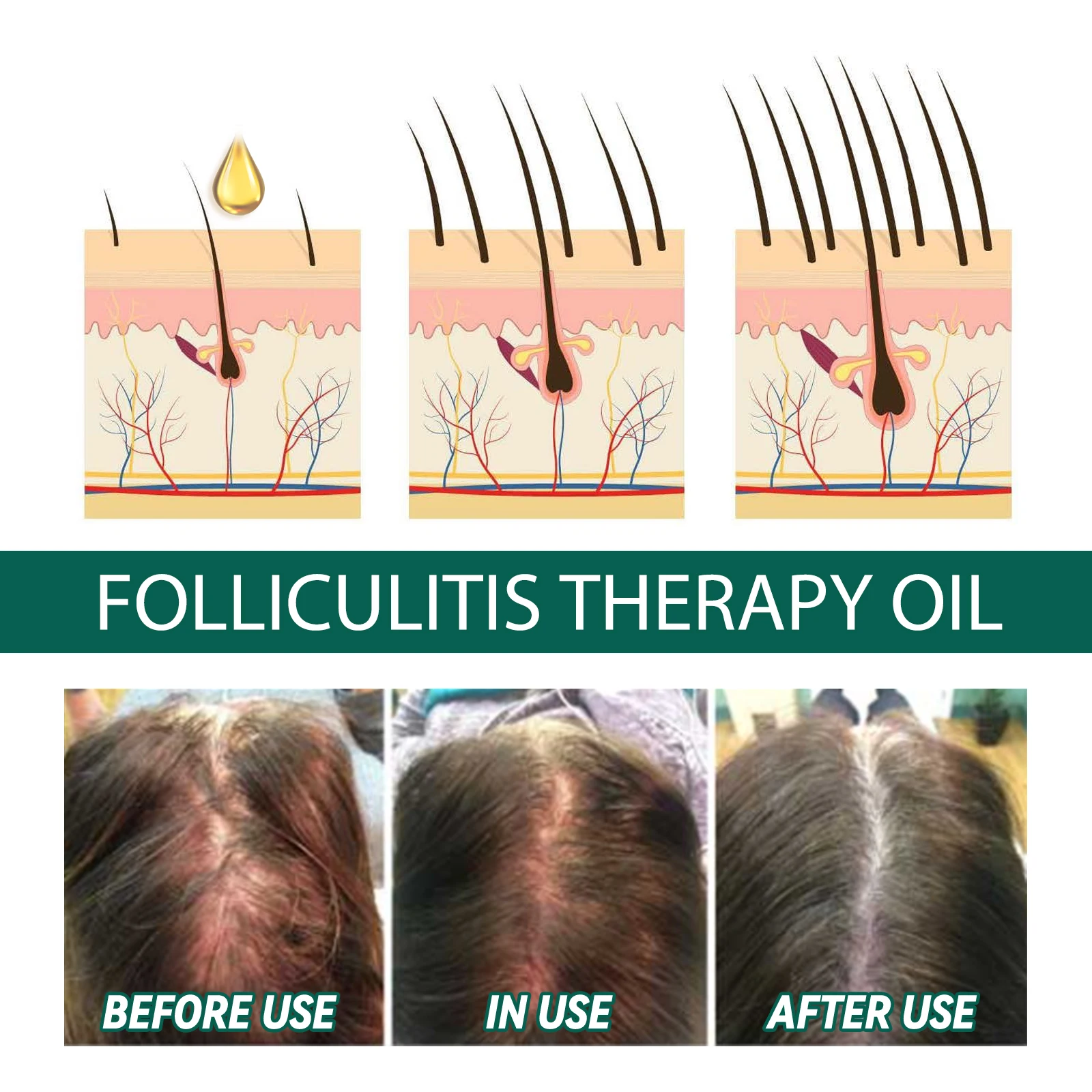 Hair Oil Serum Strengthening Smooth Silky Weak Hair Thicker Fuller Nourishing Scalp Treatment for Men Women Hair Care Products - Image 2