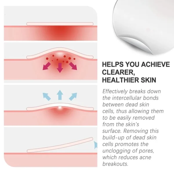 WestMonth Acne Patch Repair Acne Pimples Acne Invisible Concealer Breathable Acne Patch - Image 4