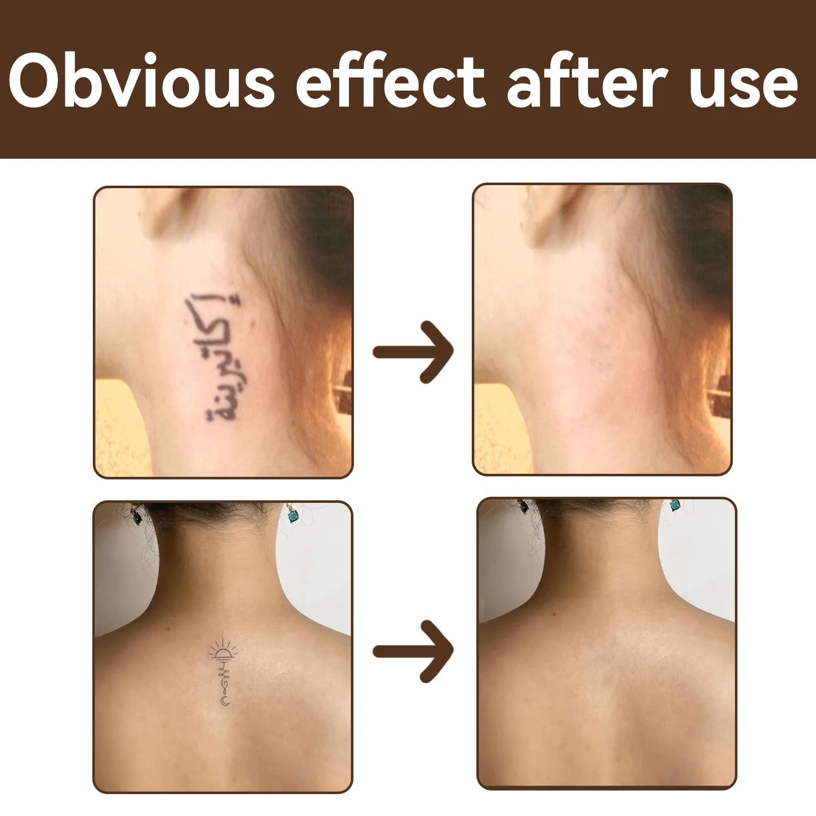 Tattoo Concealer 2 Color Waterproof Cover Up Stick, Brightening & Invisible for Tattoos, Long Lasting, Natural Look, 20g - Image 4